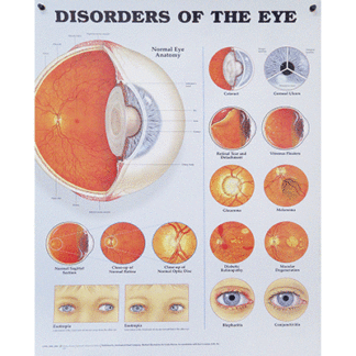 Eye Models & Posters